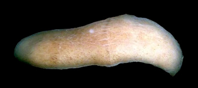 Xenoturbella